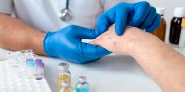 Alerta en Chiapas por aumento de casos de sarampión; piden evitar aglomeraciones