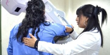 Persiste resistencia a las mastografías pese al aumento de diagnósticos