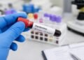 Cinco muertes bajo investigación sanitaria en Venezuela; tres casos fueron confirmados como Hantavirus