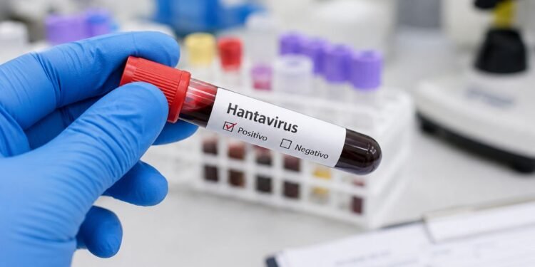 Cinco muertes bajo investigación sanitaria en Venezuela; tres casos fueron confirmados como Hantavirus