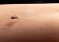 ¿Hay riesgo de contagio? Esto dicen las autoridades tras el caso de malaria en Jalisco