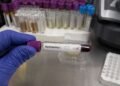 Detectan caso de hantavirus en turista que pasó por Francia y llegó a España; activan protocolos sanitarios