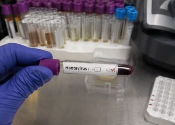 Detectan caso de hantavirus en turista que pasó por Francia y llegó a España; activan protocolos sanitarios