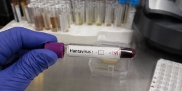 Detectan caso de hantavirus en turista que pasó por Francia y llegó a España; activan protocolos sanitarios