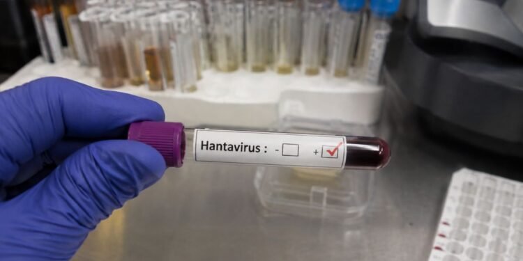 Detectan caso de hantavirus en turista que pasó por Francia y llegó a España; activan protocolos sanitarios